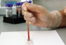 Scientists developed a new type of biosensor able to precisely quantify metabolites using a single drop of blood