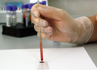 Scientists developed a new type of biosensor able to precisely quantify metabolites using a single drop of blood