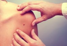 Scientists uncover why mutated cells in our skin go on to eventually form cancer