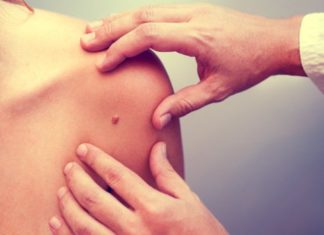 Scientists uncover why mutated cells in our skin go on to eventually form cancer