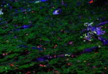 Stem cells extracted from baby teeth were able to regenerate dental pulp