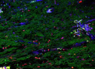 Stem cells extracted from baby teeth were able to regenerate dental pulp