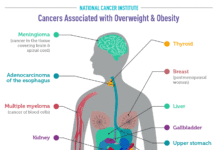 Studies have demonstrated a connection between obesity and a person’s risk of developing colon and other gastrointestinal cancers
