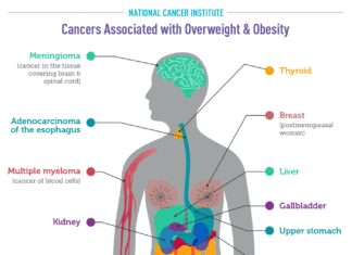 Studies have demonstrated a connection between obesity and a person’s risk of developing colon and other gastrointestinal cancers