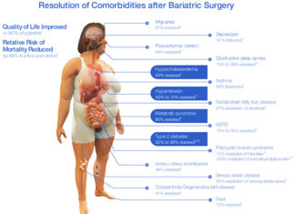 Success of long-term weight loss after bariatric surgery connected to taste preferences