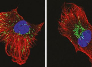 Targeting a pathway that controls the movement of mitochondria could reduce cancer invasiveness and resistance to radiotherapy