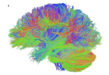 Scientists uncovered mechanisms by which high levels of a hormone called FGF23 can reduce brain health