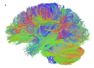 Scientists uncovered mechanisms by which high levels of a hormone called FGF23 can reduce brain health