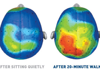 Autosomal dominant Alzheimer’s disease : benefit of physical activity on cognition and dementia progression
