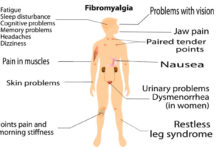 Fibromyalgia patients who regularly visit their physicians are much less likely to attempt suicide
