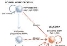 University of Colorado Cancer Center study : New combination treatment targets pre-leukemia stem cells