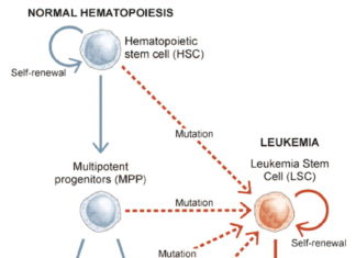 University of Colorado Cancer Center study : New combination treatment targets pre-leukemia stem cells