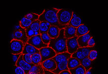Scientists are using a new technology to look at how cancer cells change under the pressure of immunotherapy treatments