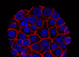 Scientists are using a new technology to look at how cancer cells change under the pressure of immunotherapy treatments