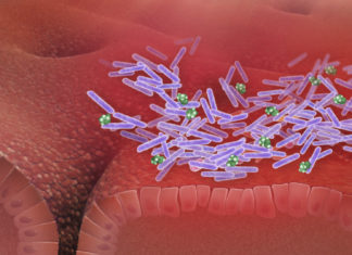 A cluster of factors may help predict which patients are likely to develop Clostridioides difficile