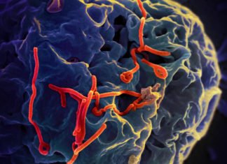 A novel synthetic DNA vaccine offers complete protection from Zaire Ebolavirus (EBOV) infection