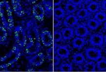 A single protein regulates a battery of key genes inside developing sperm