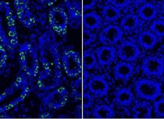 A single protein regulates a battery of key genes inside developing sperm