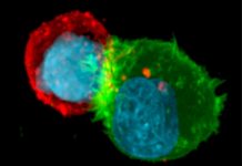 Cancer cells are able to develop resistance to immune attack by escaping from NK-mediated cell death