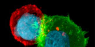 Cancer cells are able to develop resistance to immune attack by escaping from NK-mediated cell death