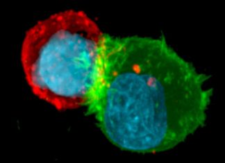 Cancer cells are able to develop resistance to immune attack by escaping from NK-mediated cell death