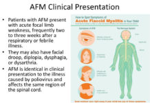 Acute flaccid myelitis, or AFM, starts out as a respiratory condition and may quickly progress to physical disability within hours