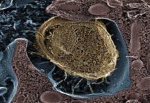 Probiotic digestive supplements helps eliminate Staphylococcus aureus