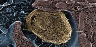Probiotic digestive supplements helps eliminate Staphylococcus aureus