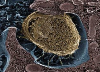 Probiotic digestive supplements helps eliminate Staphylococcus aureus