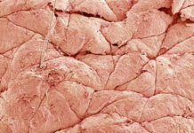 Breakthrough study to culture human skin cells called keratinocytes to produce skin grafts