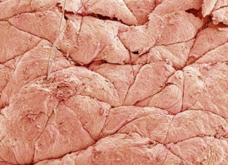 Breakthrough study to culture human skin cells called keratinocytes to produce skin grafts