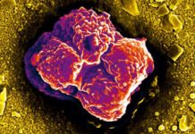 Breast cancer cells hit blood vessel walls with up to 200 times the mechanical force exerted by normal healthy cells
