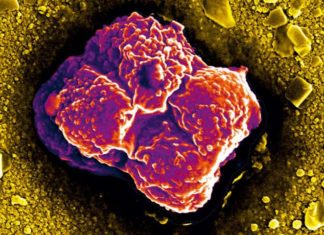 Breast cancer cells hit blood vessel walls with up to 200 times the mechanical force exerted by normal healthy cells