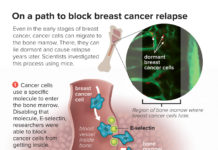 Breast cancer risk : strategy to block a part of the pathway that contributes to cancer