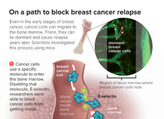 Breast cancer risk : strategy to block a part of the pathway that contributes to cancer