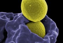 Cholesterol : generic drug side effects can targets heart disease and diabetes
