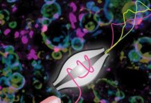 Chronic excessive caloric intake leads to the deposition of fat droplets in the liver