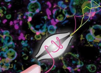 Chronic excessive caloric intake leads to the deposition of fat droplets in the liver