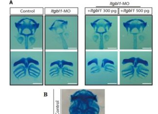 Depletion of the ITGBL1 protein reduced ECM deposition, leading to cartilage damage