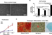 Enhancing osteogenesis with engineering teratoma-derived fibroblasts