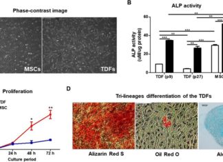 Enhancing osteogenesis with engineering teratoma-derived fibroblasts