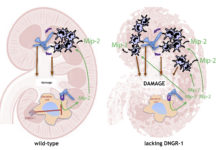 Excess inflammation increasing injury in a process known as immunopathology