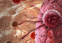 Head and neck cancers – the risk of death by suicide remains high