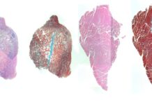 New solution for the recovery of muscular lesions and inflammations