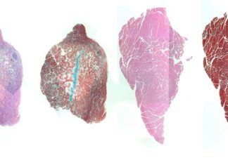 New solution for the recovery of muscular lesions and inflammations