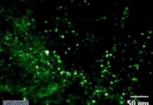 Imaging technology that detects deadly pneumonia infections in under 60 seconds is safe and practical for clinical use