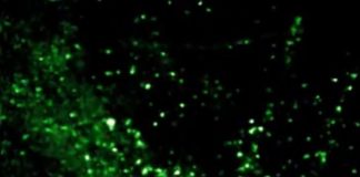 Imaging technology that detects deadly pneumonia infections in under 60 seconds is safe and practical for clinical use
