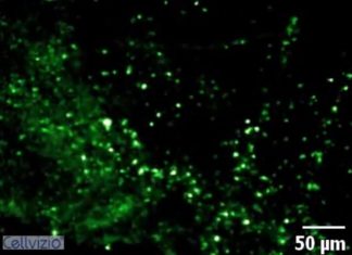 Imaging technology that detects deadly pneumonia infections in under 60 seconds is safe and practical for clinical use