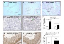 Inflammation in the womb may explain link between prenatal inflammation and postnatal immune status