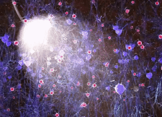 Machine learning could help to find new treatments for dementia